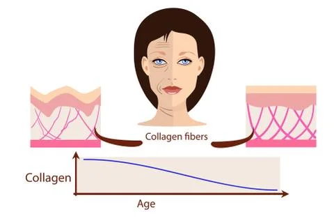 Vector face and two types of skin - aged and young for medical and Stock Illustration
