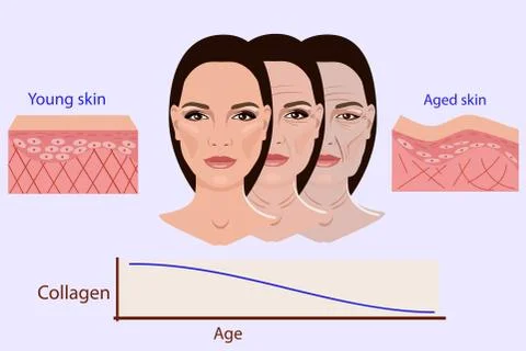 Vector face and two types of skin - aged and young for medical and Stock Illustration
