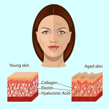Vector face and two types of skin - aged and young for medical and Stock Illustration