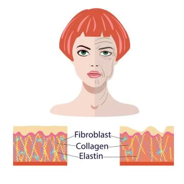 Vector face and two types of skin - aged and young for medical and Stock Illustration