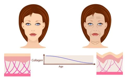Vector faces and two types of skin - aged and young for medical and Stock Illustration