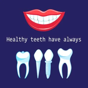 Vector healthy teeth and implants Stock Illustration