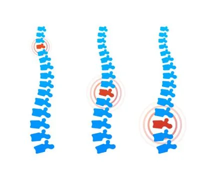 Vector human spine with pain isolated silhouette illustration. Spine pain med Illustrazione stock