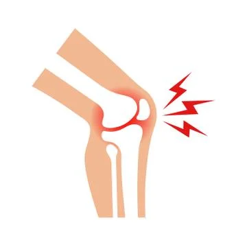 Vector illstration of joint pain icon. Flat design. Isolated. Stock Illustration