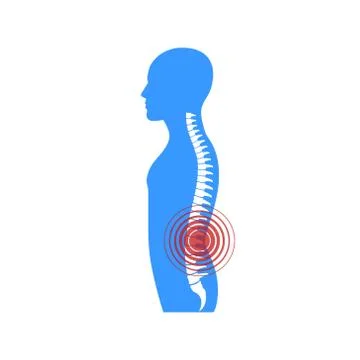Vector illstration of spine pain on white background. Isolated. Stock Illustration