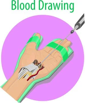 Vector illustration of Blood drawing Stock Illustration