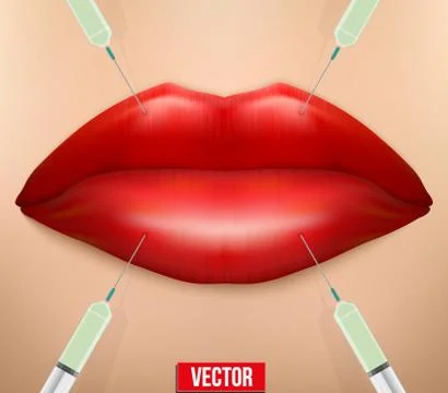 Vector illustration of a botox injection. Stock Illustration
