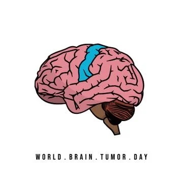 Vector Illustration of Brain with brain tumor concept design Stock Illustration
