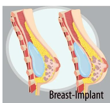 Vector illustration of Breast anatomy Stock Illustration