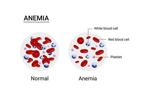 Vector illustration of the difference of number of healthy red blood cells. Stock-Illustration