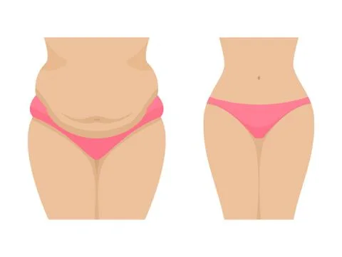 Vector illustration of a fat and thin female belly Illustrazione stock