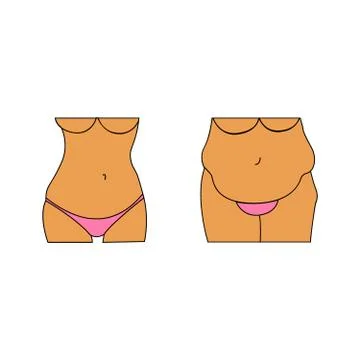 Vector illustration of a fat and thin female belly. Stock Illustration