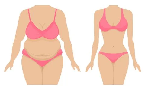 Vector illustration of a fat and thin female body Stock Illustration