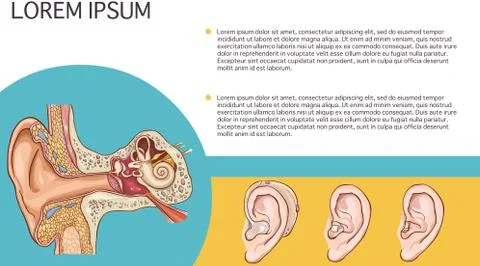 Vector illustration of hearing aid and girdle anatomy Stock Illustration