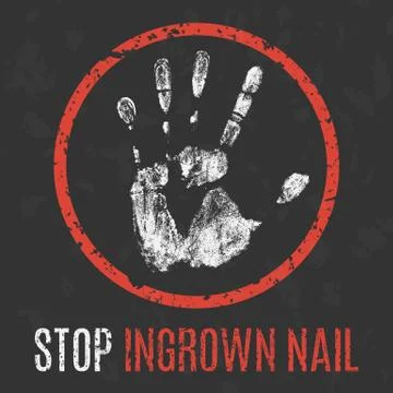 Vector illustration. Human diseases. Stop ingrown nail. 스톡 일러스트