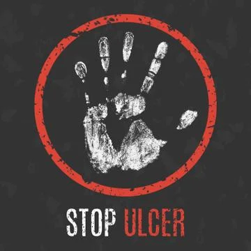 Vector illustration. Human diseases. Stop ulcer. Stock Illustration