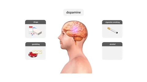 Vector illustration of human head with vertigo for addiction types and diag.. Stock Footage 256167499