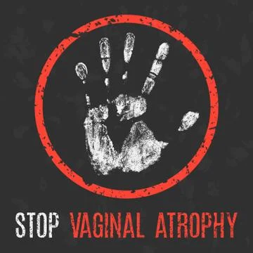 Vector illustration. Human sickness. Stop vaginal atrophy. Ilustración de archivo