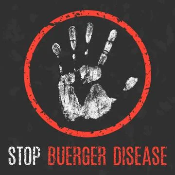 Vector illustration. Human sickness. Stop buerger diseas. Stock Illustration