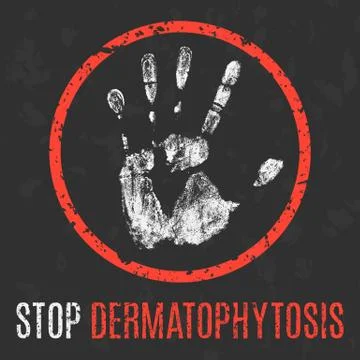 Vector illustration. Human sickness. Stop dermatophytosis. Stock Illustration