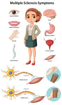 Vector Illustration of Multiple Sclerosis Symptoms and Effects Illustrazione stock