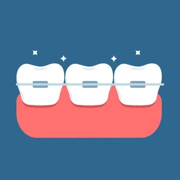 Vector illustration of teeth with braces Stock Illustration