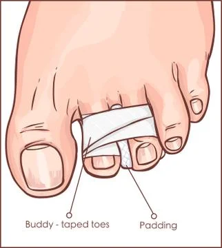Vector illustration of a Toe Buddy Taping Stock Illustration