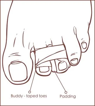 Vector illustration of a Toe Buddy Taping Stock Illustration
