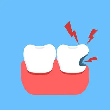 Vector illustration of toothache pain caused by broken teeth and cavities イラスト素材