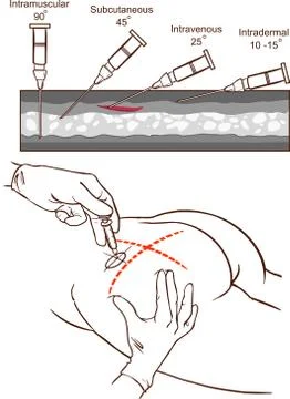Vector illustration of a veins of the arm. Science, medical. Illustrazione stock