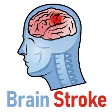 Vector Illustration of World Stroke Day with Red Epicenter Stock Illustration