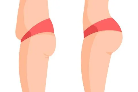 Vector image of a fat and a fit butts and bellys side view. Concept of before Stock Illustration