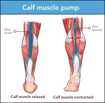 Vector ?llustration of a Calf muscle pump Stock Illustration