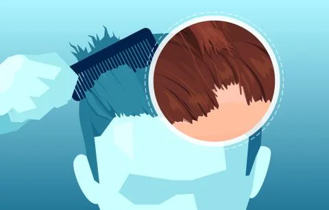 Vector of a man combing and loosing hair Stock Illustration