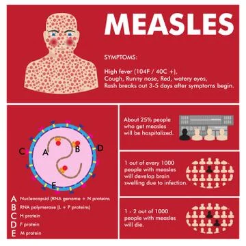 Vector measles infographic Stock Illustration