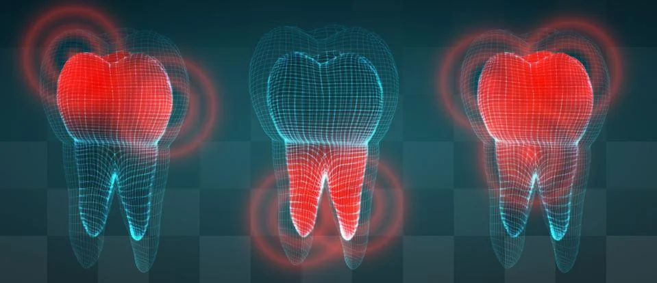Vector set of 3d teeth on a dark background. toothache. Illustrazione stock