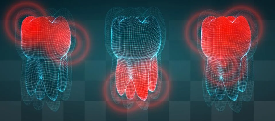 Vector set of 3d teeth on a dark background. toothache. Illustrazione stock