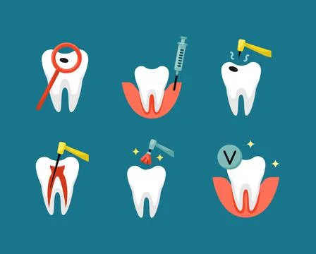 Vector set of flat dentistry icons. Pulpitis treatment Stock-Illustration