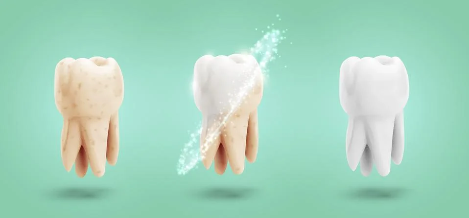 Vector set of three molars. tooth cleaning, care and protection Stock Illustration