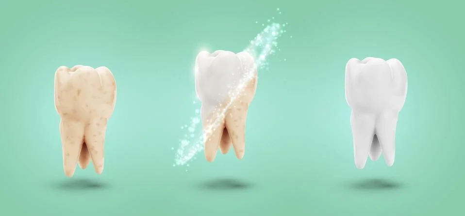 Vector set of three molars. tooth cleaning, care and protection Stock Illustration