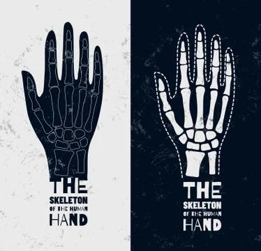 Vector Skeleton Hands. Sign or logo on the medical theme. Vector illustration Stock Illustration
