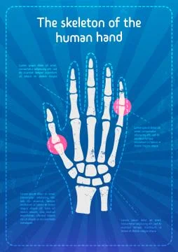 Vector Skeleton Hands. X-ray of the hand Bones.The Concept of a Flyer or Poster Stock Illustration