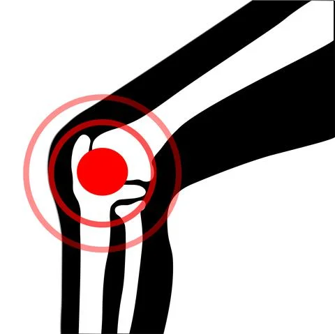 Vector symbol of knee joint bones with paint for orthopedic purposes. Stock Illustration