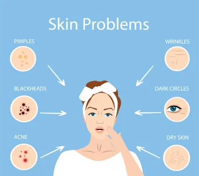 Vector of a woman with face skin problems Illustrazione stock
