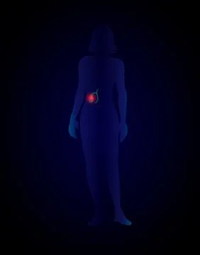 Vector x ray gallbladder infographics. silhouette of a woman with a gallbladd Illustrazione stock