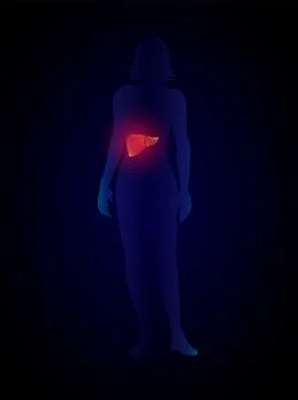 Vector x ray liver infographics. silhouette of a woman with a liver, liver di Illustrazione stock