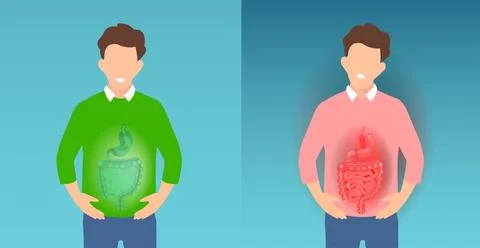 Vector of a young man with belly pain and gastrointestinal tract inflammati.. イラスト素材