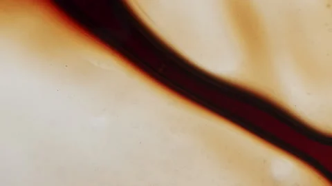 Vein getting squished creating small air bubbles. Video stock 136260514