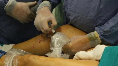 Vein injection Stock Photos