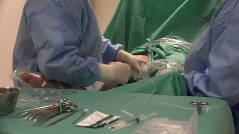 Vein Laser Surgery 4 動画素材 108048672